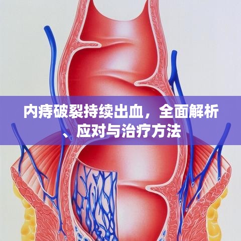 內(nèi)痔破裂持續(xù)出血，全面解析、應(yīng)對與治療方法