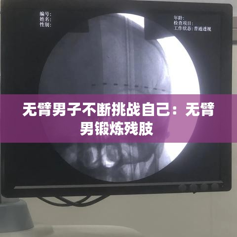 無臂男子不斷挑戰(zhàn)自己：無臂男鍛煉殘肢 