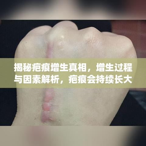 揭秘疤痕增生真相，增生過程與因素解析，疤痕會持續(xù)長大嗎？
