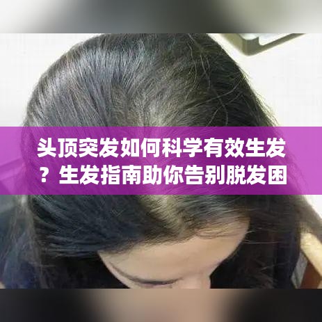 頭頂突發(fā)如何科學(xué)有效生發(fā)？生發(fā)指南助你告別脫發(fā)困擾！