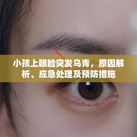 小孩上眼瞼突發(fā)烏青，原因解析、應(yīng)急處理及預(yù)防措施
