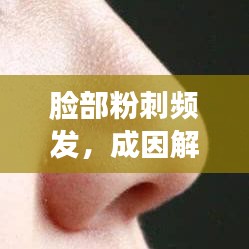 臉部粉刺頻發(fā)，成因解析與防治管理策略